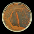 Orange bacterial colonies culture on agar plate isolated on black