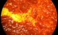 Orange chemical substance, ferrocene, under a microscope