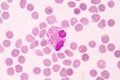 Eosinophil white blood cells on red blod cell background