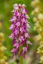 Orchis anthropophora x Orchis italica a perennial wild herbaceous plant belonging to the family Orchidace Royalty Free Stock Photo