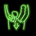 organ prolapse disease neon glow icon illustration