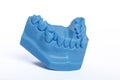 Orthodontic Blue Lower Jaw Model used in dentistry for demonstration. Royalty Free Stock Photo