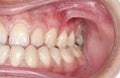 Orthodontic condition