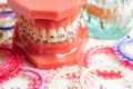 Orthodontic ligatures rings and ties, elastic rubber bands on orthodontic braces, model for dentist studying about dentistry Royalty Free Stock Photo