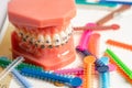 Orthodontic ligatures rings and ties, elastic rubber bands on orthodontic braces, model for dentist studying about dentistry Royalty Free Stock Photo