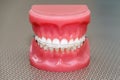 Orthodontic model and dentist tool - demonstration teeth model with ceramic braces on teeth on an artificial jaws closeup Royalty Free Stock Photo