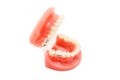 Orthodontic model and dentist tool - demonstration teeth model with ceramic braces on teeth on an artificial jaws Royalty Free Stock Photo