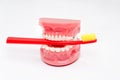 Orthodontic model and dentist tool - teeth model with ceramic braces on an artificial jaws closeup. Jaw model with red toothbrush Royalty Free Stock Photo
