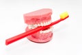 Orthodontic model and dentist tool - teeth model with ceramic braces on an artificial jaws closeup. Jaw model with red toothbrush Royalty Free Stock Photo