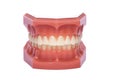 Orthodontic Model used in dentistry for demonstration and educational purposes