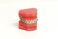 Orthodontic mold of a dental appliance