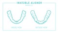 Orthodontic silicone trainer. Invisible braces aligner, retainer.