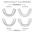 Orthodontic silicone trainer. Invisible braces aligner, retainer.