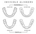 Orthodontic silicone trainer. Invisible braces aligner, retainer.