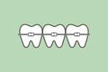 Orthodontic teeth or dental braces