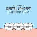 Orthodontic teeth illustration vector on blue background. Denta