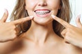 Orthodontic Treatment. Dental Care Concept. Beautiful Woman Healthy Smile close up. Closeup Ceramic and Metal Brackets