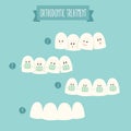 Orthodontic treatment (tooth braces) illustration