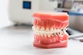 Orthodontics dental braces on teeth model to align teeth