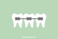 Orthodontics teeth or dental braces