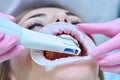 Orthodontist scaning patient with dental intraoral 3d scanner