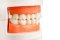 Orthognathic correct bite on the model of the jaws, orthodontic and aesthetic treatment Royalty Free Stock Photo