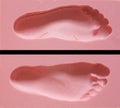 Orthopedic foam mold footprint medical footprint foam block