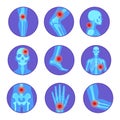 Orthopedic joint diseases. Rheumatoid pain bone knee hand elbow arthritis, rheumatology human skeleton body xray