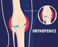 orthopedics rheumatism arthritis