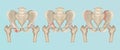 Orthopedics of pelvis and hip fracture