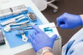 An orthopedist dentist prepares a polymer material for making a dental working model.