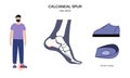 Orthotic shoe and insoles Royalty Free Stock Photo