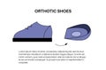 Orthotic shoe and insoles Royalty Free Stock Photo