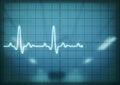 Oscilloscope screen showing heartbeat