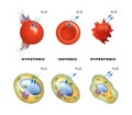 Osmotic pressure in plant and animal cells