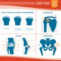 Osteoarthritis and rheumatism joint pain medical vector infographic Royalty Free Stock Photo