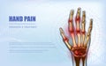 Osteoarthritis rheumatoid arthritis hand sore joints concept Royalty Free Stock Photo