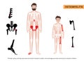 Osteomyelitis in child and adult