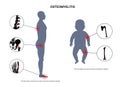 Osteomyelitis disease poster