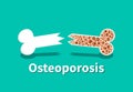 Osteoporosis, Bone structure in vector art Royalty Free Stock Photo