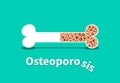 Osteoporosis, Bone structure in vector design Royalty Free Stock Photo