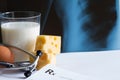 Osteoporosis calcium dairy product and x-ray photo Royalty Free Stock Photo