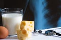 Osteoporosis calcium dairy product and x-ray photo Royalty Free Stock Photo