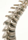 Osteoporosis curvature stages of the spine - 3D Rendering