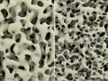 Osteoporosis, healthy leftI and osteoporotic right bone tissue