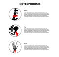 Osteoporosis medical poster