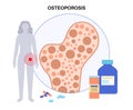 Osteoporosis medical poster