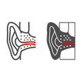 Otitis media line and solid icon, Human diseases concept, Ear disease sign on white background, Otitis icon in outline