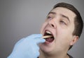 An otolaryngologist examines a man`s throat with a wooden spatula. A possible diagnosis is inflammation of the pharynx, tonsils o