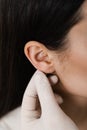 Otoplasty ear surgery close-up. Surgeon doctor examines girl ears before otoplasty cosmetic surgery. Otoplasty surgical